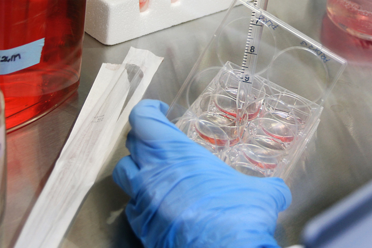 student working in a lab with a pipette and petri dishes